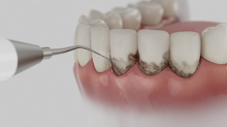 Trusted Teeth Cleaning And Checkup service in Auburn, MI - Dentist Open Now